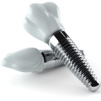 Implantologie Köln: Implantate von Zahnarzt Dr. Narouz